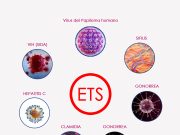 Enfermedades de transmisión sexual (ETS)