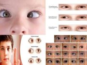 Aumento de casos de estrabismo infantil por el uso excesivo de dispositivos digitales post pandemia por COVID-19 y su intervención fisioterapéutica en México.